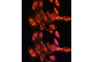 Immunofluorescence analysis of C6 cells using FSTL1 antibody (ABIN7267227) at dilution of 1:100. (FSTL1 抗体  (AA 1-308))