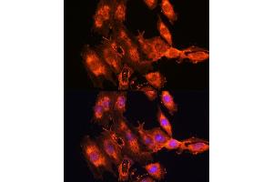 Immunofluorescence analysis of C6 cells using FSTL1 antibody (ABIN7267227) at dilution of 1:100. (FSTL1 抗体  (AA 1-308))