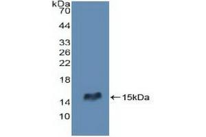 Western blot analysis of recombinant Human RIPK2. (RIPK2 抗体  (AA 432-540))