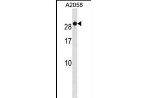 RAB7B Antibody (C-term) (ABIN1881722 and ABIN2838881) western blot analysis in  cell line lysates (35 μg/lane). (RAB7B 抗体  (C-Term))