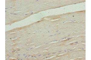 Immunohistochemistry of paraffin-embedded human skeletal muscle tissue using ABIN7175577 at dilution of 1:100 (CACNA2D1 抗体  (AA 577-717))
