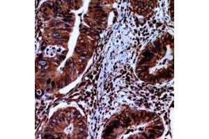 Immunohistochemical analysis of FABP2 staining in human small intestine formalin fixed paraffin embedded tissue section. (FABP2 抗体  (C-Term))