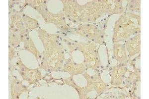 Immunohistochemistry of paraffin-embedded human kidney tissue using ABIN7148290 at dilution of 1:100 (TMEM27 抗体  (AA 15-141))