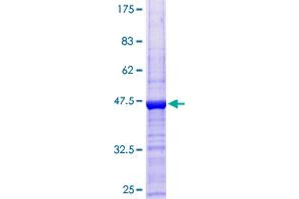 POMP Protein (AA 1-141) (GST tag)