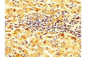 Immunohistochemistry (IHC) image for anti-Sodium Channel, Nonvoltage-Gated 1, beta (SCNN1B) (AA 554-640) antibody (ABIN7143973)