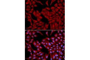 Immunofluorescence analysis of U2OS cell using DCTN2 antibody. (Dynamitin 抗体  (AA 50-320))