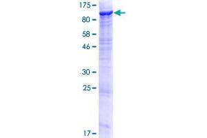 ECE1 Protein (AA 1-770) (GST tag)