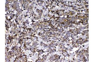 IHC analysis of Vitamin D Binding protein using anti-Vitamin D Binding protein antibody . (Gc (AA 17-256) 抗体)