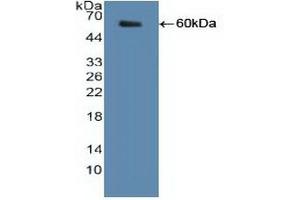 Detection of Recombinant SHMT2, Human using Polyclonal Antibody to Serine Hydroxymethyltransferase 2, Mitochondrial (SHMT2) (SHMT2 抗体  (AA 30-504))