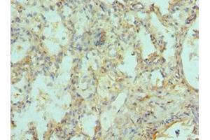 Immunohistochemistry of paraffin-embedded human lung tissue using ABIN7151217 at dilution of 1:100 (SIAH1 抗体  (AA 1-313))