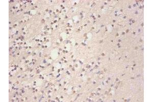 Immunohistochemical of paraffin-embedded human brain tissue using ABIN7152718 at dilution of 1:200 (FTL 抗体)
