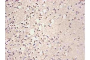 Immunohistochemical of paraffin-embedded human brain tissue using ABIN7152718 at dilution of 1:200