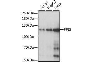Western blot analysis of extracts of various cell lines, using PPIG antibody (ABIN6292236) at 1:1000 dilution. (PPIG 抗体)