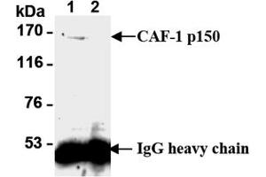 Western Blotting (WB) image for anti-Chromatin Assembly Factor 1, Subunit B (p60) (CHAF1B) antibody (ABIN1105633) (CHAF1B 抗体)