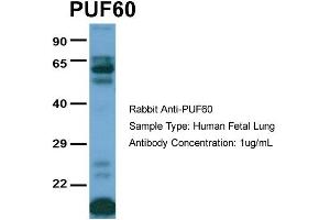 Host:  Rabbit  Target Name:  PUF60  Sample Type:  Human Fetal Lung  Antibody Dilution:  1. (PUF60 抗体  (C-Term))