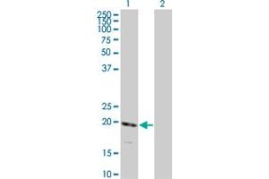 Western Blot analysis of RNF122 expression in transfected 293T cell line by RNF122 monoclonal antibody (M01), clone 5E5. (RNF122 抗体  (AA 61-155))