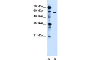 Western Blotting (WB) image for anti-Zinc Finger, DHHC-Type Containing 13 (ZDHHC13) antibody (ABIN2462814) (ZDHHC13 抗体)
