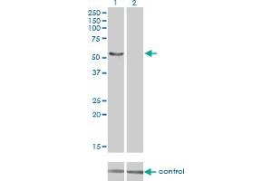 Western blot analysis of IRX6 over-expressed 293 cell line, cotransfected with IRX6 Validated Chimera RNAi (Lane 2) or non-transfected control (Lane 1). (IRX6 抗体  (AA 337-446))