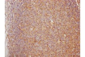 IHC image of ABIN7147565 diluted at 1:100 and staining in paraffin-embedded human lymph node tissue performed on a Leica BondTM system. (Chitotriosidase 1 抗体  (AA 215-430))