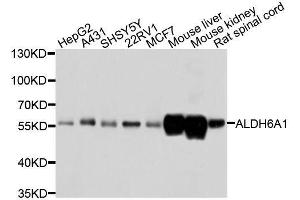 Western blot analysis of extracts of various cell lines, using ALDH6A1 antibody. (ALDH6A1 抗体  (AA 326-535))