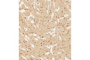 (ABIN6244226 and ABIN6577745) staining WDR82 in human brain tissue sections by Immunohistochemistry (IHC-P - paraformaldehyde-fixed, paraffin-embedded sections). (WDR82 抗体  (N-Term))