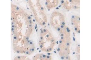 IHC-P analysis of Human Tissue, with DAB staining. (AGRP 抗体  (AA 20-130))