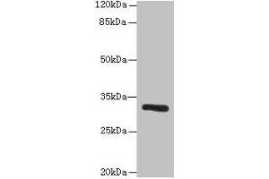 Western blot All lanes: PPP1R3B antibody at 6 μg/mL + Mouse liver tissue Secondary Goat polyclonal to rabbit IgG at 1/10000 dilution Predicted band size: 33 kDa Observed band size: 33 kDa (PPP1R3B 抗体  (Regulatory Subunit 3B))