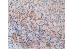 IHC-P analysis of Mouse Stomach Tissue, with DAB staining, using IL12Rb2 Antibody (20 μg/ml) and HRP-conjugated Goat Anti-Rabbit antibody (abx400043, 2 µg/ml). (IL12RB2 抗体  (AA 285-441))