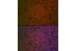 Immunofluorescence (IF) image for anti-Coagulation Factor IX (F9) (AA 29-192) antibody (ABIN3022174)