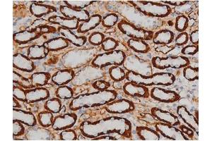 ABIN6267399 at 1/200 staining Rat kidney tissue sections by IHC-P. (CREB1 抗体  (pSer142))