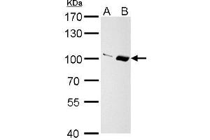 WB Image Importin 13 antibody [C3], C-term detects Importin 13 protein by Western blot analysis. (IPO13 抗体  (C-Term))