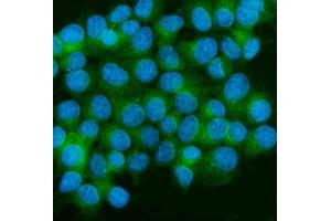 IF analysis of CaMKII alpha/CAMK2A using anti-CaMKII alpha/CAMK2A antibody (ABIN7599429). (CAMK2A 抗体  (AA 1-478))