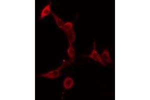 ABIN6275911 staining  HeLa cells by IF/ICC. (Serotonin Receptor 5A 抗体  (Internal Region))