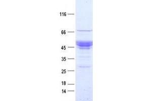 Validation with Western Blot