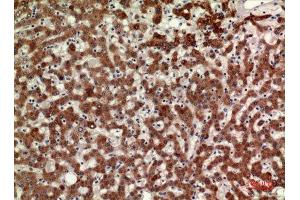 Immunohistochemistry (IHC) analysis of paraffin-embedded Human Liver, antibody was diluted at 1:100. (MPL 抗体  (Internal Region))
