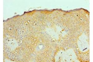Immunohistochemistry of paraffin-embedded human skin tissue using ABIN7143180 at dilution of 1:100 (ACVR2A 抗体  (AA 20-140))