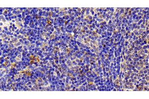 Immunohistochemistry (IHC) image for anti-S100 Calcium Binding Protein A12 (S100A12) (AA 2-92) antibody (ABIN7443992)