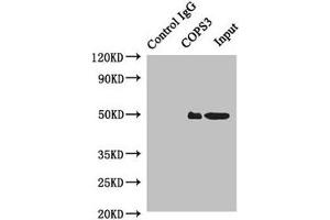 COPS3 抗体  (AA 194-423)