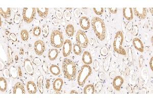 Detection of RRM1 in Human Kidney Tissue using Polyclonal Antibody to Ribonucleotide Reductase M1 (RRM1)