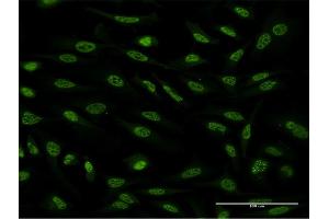 Immunofluorescence of monoclonal antibody to OXSR1 on HeLa cell. (OXSR1 抗体  (AA 351-450))