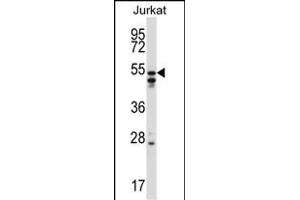 HNRNPH2 Antibody (C-term) (ABIN657420 and ABIN2846457) western blot analysis in Jurkat cell line lysates (35 μg/lane). (HNRNPH2 抗体  (C-Term))