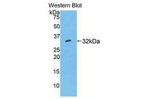 Western Blotting (WB) image for anti-Serpin Family A Member 7 (SERPINA7) (AA 127-393) antibody (ABIN1078580) (SERPINA7 抗体  (AA 127-393))