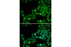 Immunofluorescence analysis of U2OS cells using POLK antibody (ABIN5973607). (POLK 抗体)