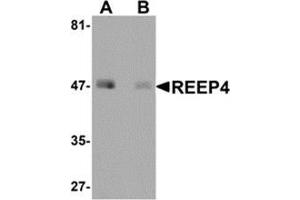 Western blot analysis of REEP4 in human lung tissue lysate with REEP4 antibody at 1 μg/ml in (A) the absence and (B) the presence of blocking peptide. (Receptor Accessory Protein 4 抗体  (Center))
