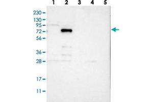 Western blot analysis of Lane 1: RT-4, Lane 2: U-251 MG, Lane 3: Human Plasma, Lane 4: Liver, Lane 5: Tonsil with VEZT polyclonal antibody . (VEZT 抗体)