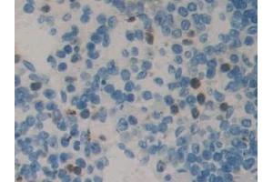 Detection of NME5 in Mouse Spleen Tissue using Polyclonal Antibody to Non Metastatic Cells 5, Protein NM23A Expressed In (NME5) (NME5 抗体  (AA 16-210))