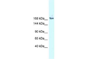 WB Suggested Anti-SNRNP200 Antibody Titration: 1. (SNRNP200 抗体  (N-Term))