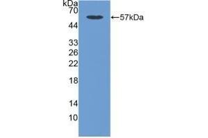 Detection of Recombinant CDHOB, Human using Polyclonal Antibody to Cadherin, Osteoblast (CDHOB) (OB Cadherin 抗体  (AA 374-595))