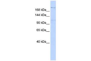 WB Suggested Anti-INADL Antibody Titration:  0.