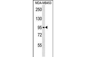 Western blot analysis in MDA-MB453 cell line lysates (35ug/lane). (FBXO11 抗体  (N-Term))